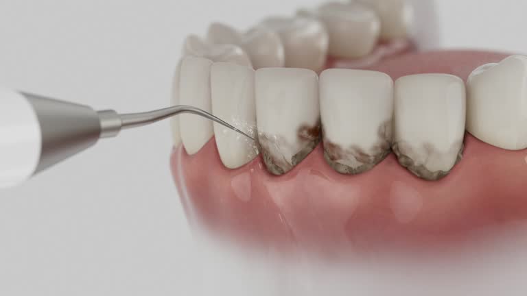 Trusted Teeth Cleaning And Checkup service in Williamsport, OH - Dentist Open Now